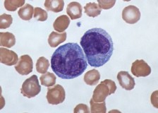 На что указывают моноциты в анализе крови?
