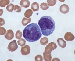 На что указывают моноциты в анализе крови?