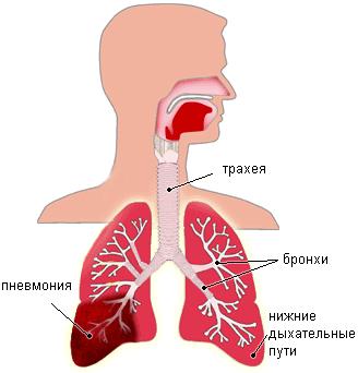 Как узнать пневмонию по анализу крови thumbnail