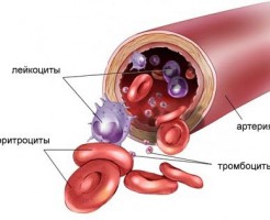 Вычисление заболеваний крови по анализу крови