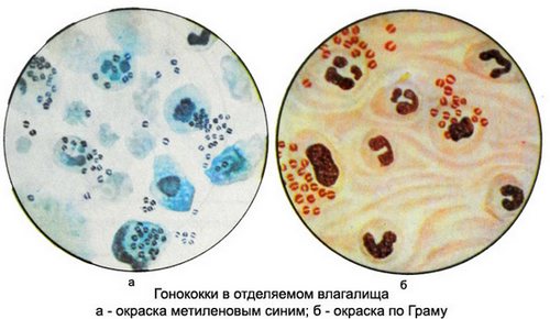 Определение бактерий