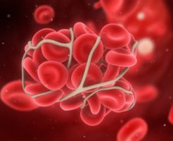 Показатель сворачиваемости крови в анализе на фибриноген