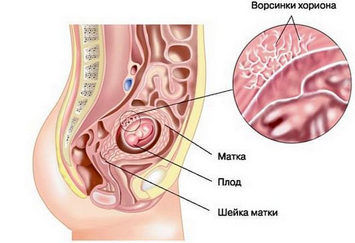 Биопсия ворсин хориона в Киеве ~ ICSI Clinic