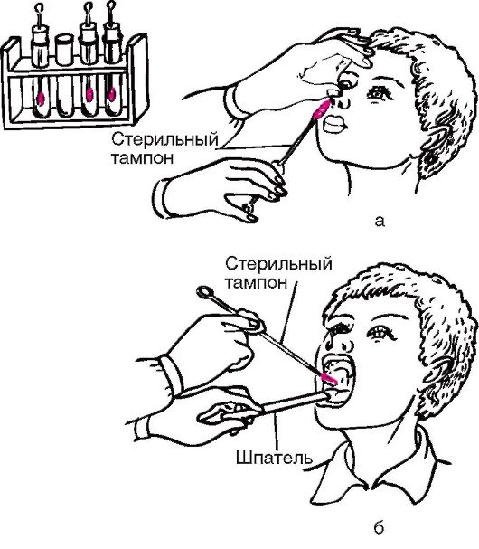 Взятие биоматериала из носа и зева
