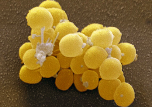 Бактерии золотистого стафилококка