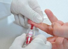 Этиология повышенных тромбоцитов у ребенка в крови
