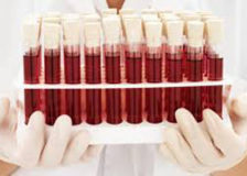 Анализ на общий белок в крови — что это такое?