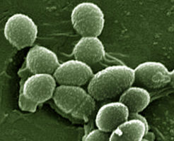 Присутствие Enterococcus faecalis в мазке