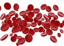 Анемия или малокровие  — чем опасен низкий гемоглобин?