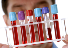 Диагностика крови — уровень фибриногена повышен