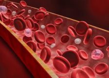 Методы понижения лейкоцитов в крови