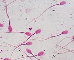 Причины повышения уровня лейкоцитов в сперме
