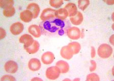 Разновидность лейкоцитов — палочкоядерные нейтрофилы