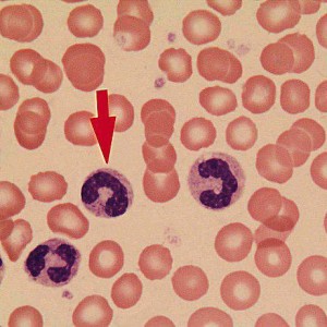 Что означают палочкоядерные в анализе крови