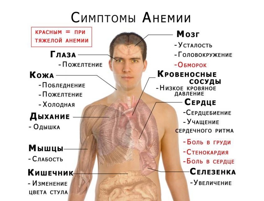 Симптомы болезни