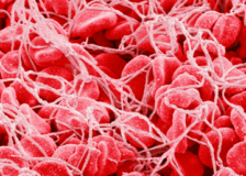 Как можно повысить тромбоциты в крови?